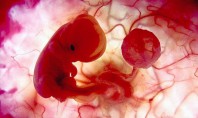 Ανθρώπινο έμβρυο αναπτύσσεται στο εργαστήριο