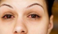7 προβλήματα στα μάτια που προκαλούνται ή επιδεινώνονται από το κάπνισμα