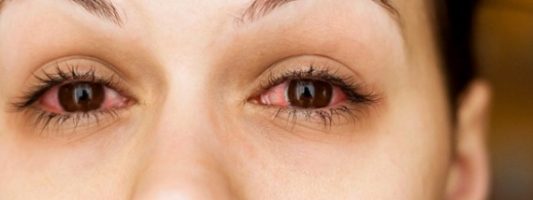 7 προβλήματα στα μάτια που προκαλούνται ή επιδεινώνονται από το κάπνισμα
