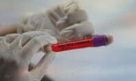 PCR και Rapid test: Έρχονται καμπάνες για όσους χρεώνουν παραπάνω από αύριο